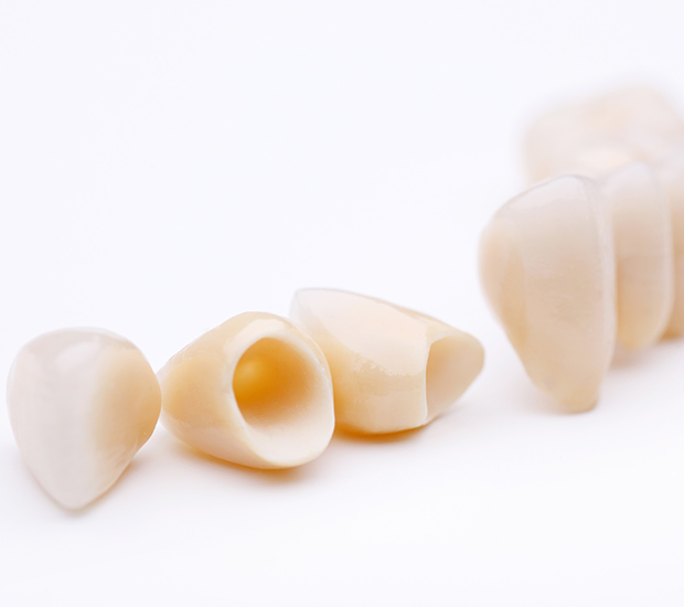 Suffolk Dental Crowns and Dental Bridges