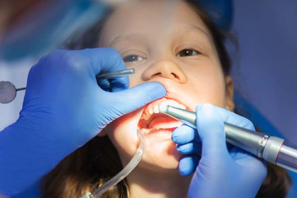 Is Teeth Whitening For Kids Safe?